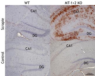 Les MT 1+2 estan involucrades en la patogènia de les EETs