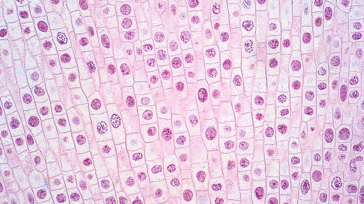 imatge representant de cromatides germanes