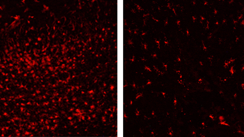 Cèl·lules de micròglia. En un cervell de ratolí sense tractar (esquerra) i tractat (dreta)