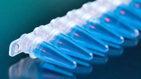 Generic photo of lab objects (pipettes)
