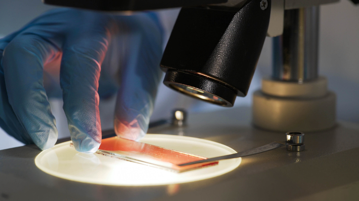 Anàlisi en microscopi d'una mostra del frotis