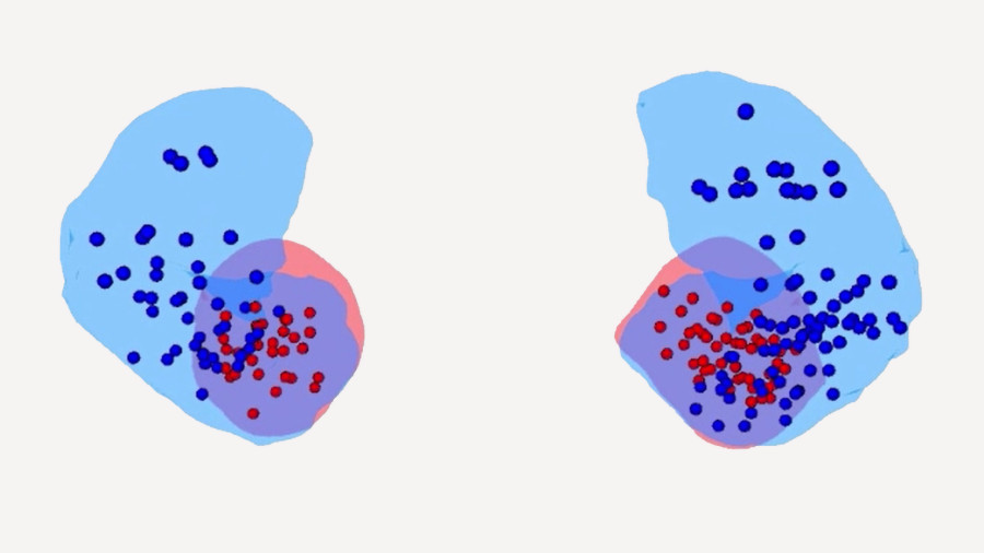 Electrodes visualization