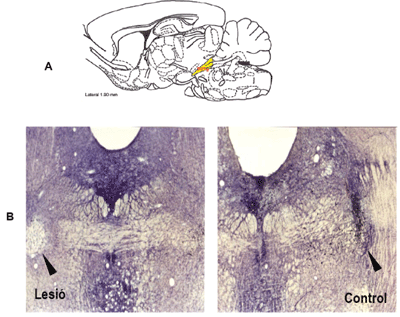 Lesió al nucli pedunculopòntic tegmental en el cervell de rata