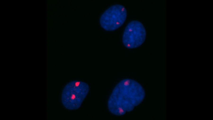 Nuclis de cèl·lules de ratolí femella amb les dues còpies del cromosoma X marcades en vermell