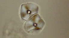 Microfossil extracted from dental calculus of hominins of Qesem Cave (Israel)