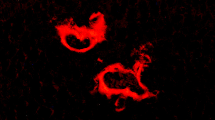 Amiloidosi del fetge en ratolins