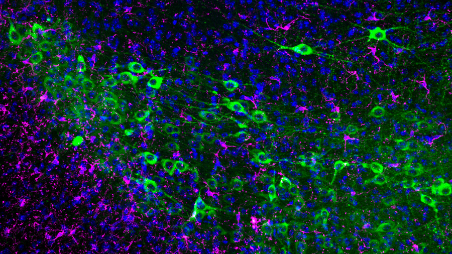 En verd, neurones dopaminèrgiques de ratolí (substància nigra). En magenta, microglia. En blau, els 