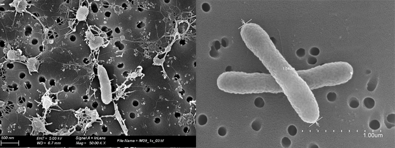 Imágenes de microscopio de la bacteria Parvicella tangerina i la Lysobacter luteus 